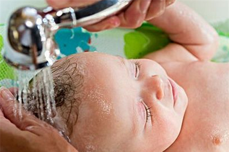 宝宝头上胎脂要洗掉吗？