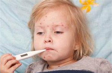 宝宝出水痘有什么症状？