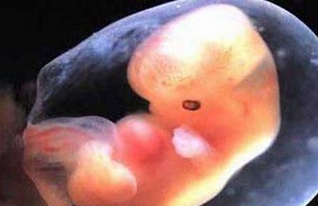 怀孕6周胚芽有多大