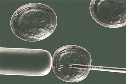 人工受孕的具体步骤是什么