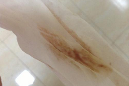 怀孕6周有褐色分泌物正常吗