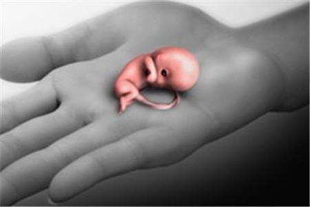 引产对身体伤害大吗