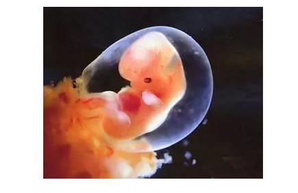 怀孕60天未见胚芽正常吗？