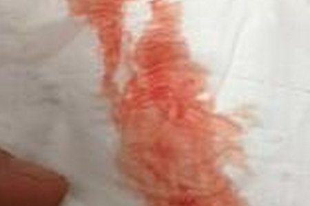 怀孕9周见红了但是不痛怎么办