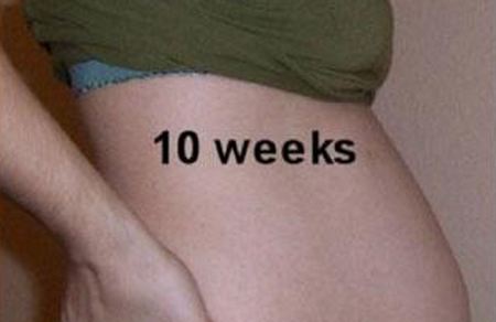 怀孕10周有什么症状