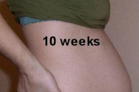 怀孕10周有什么症状