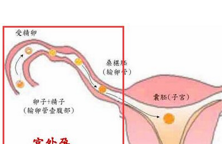 怀孕10周注意事项