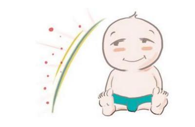 宝宝长痱子了！怎么对付好？