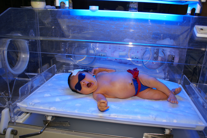 新生儿黄疸照蓝光有副作用吗