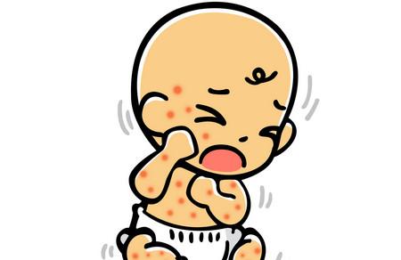 宝宝出疹子你怕不怕？史上最全出疹攻略