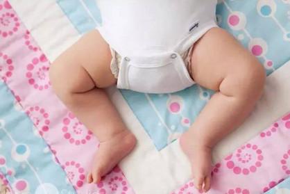 幼儿o型腿矫正方法与预防