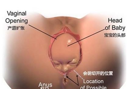 为什么侧切的人越来越多？知道真相的我惊呆了