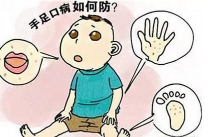 手足口病高峰期来了，收好这份儿科医生传授的秘籍！