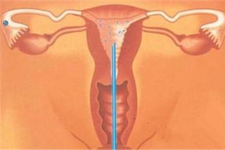 女人阴道有多深