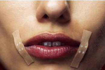 嘴角烂了怎么办