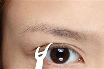 单眼皮怎么变双眼皮