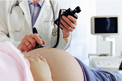 唐氏筛查看男女