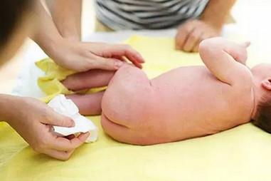 宝宝红屁屁，涂茶油管用吗？