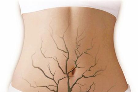 囊肿是怎么形成的