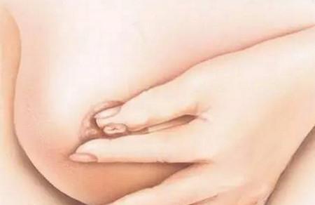 乳头内陷？五种方法“拔”出来！