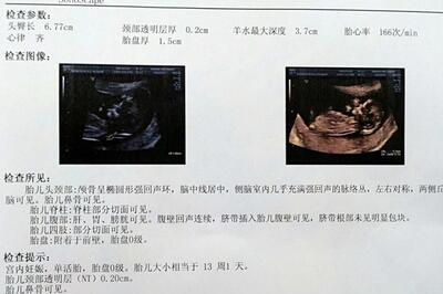 怀孕几个月可以看男女