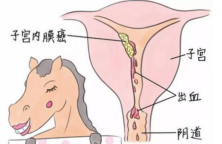 绝经以后哪怕出一点血也需要注意！