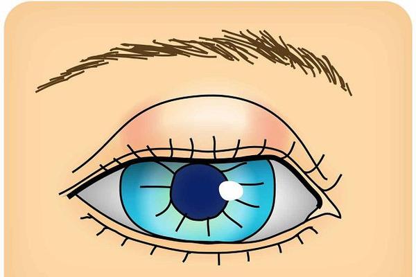 针眼是怎么引起的