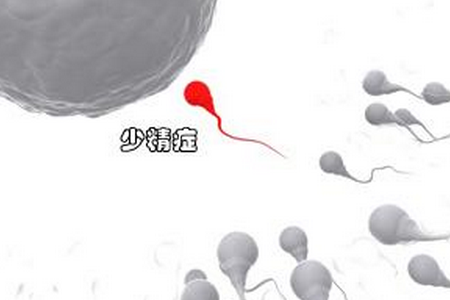 少精、弱精患者怎么办，才能提高老婆的受孕率呢？