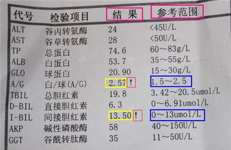 肝功能化验单