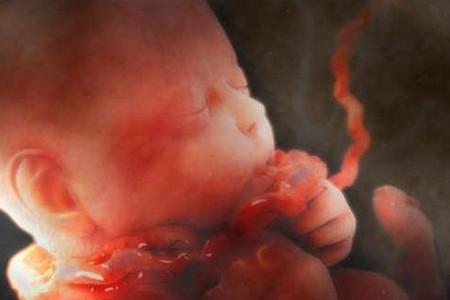 胎宝宝出现这种情况准妈莫惊慌，这么做保你母子平安！