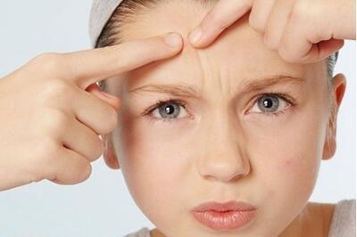 长痘痘了怎么消除