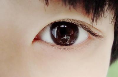 近视眼手术利与弊