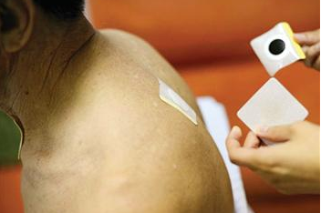 三伏贴烫伤了怎么办