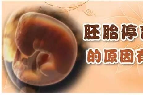你为什么会遭遇胎停育?医生教你如何避免再次胎停育！