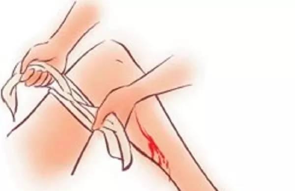 当孩子发生出血、溺水、抽搐、热衰竭、发热时，可以这样处理