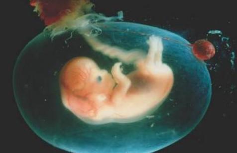 孕妇生出一个透明“大水球”，可宝宝哪去了？