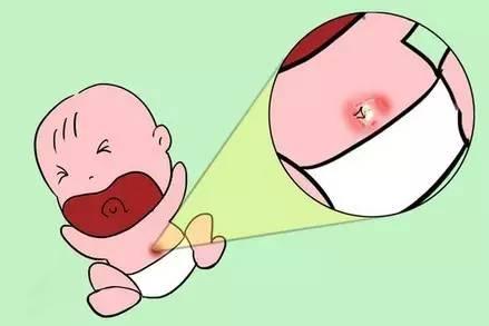 宝宝肚脐有肿块原来大哭是祸首