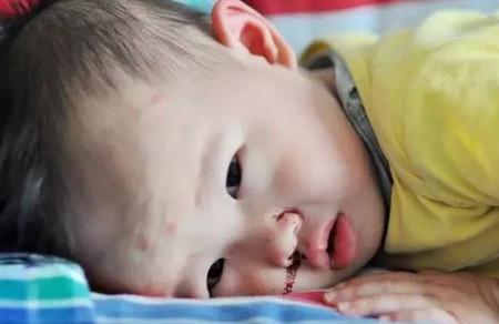妈妈这样止鼻血的方式毁了孩子，九成的人曾犯过！