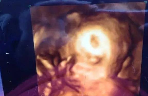 这一孕周胎儿就能睁眼看到光了，还能感受到妈妈的抚摸！