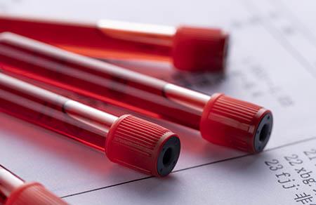 什么样的眼睛适合开眼角