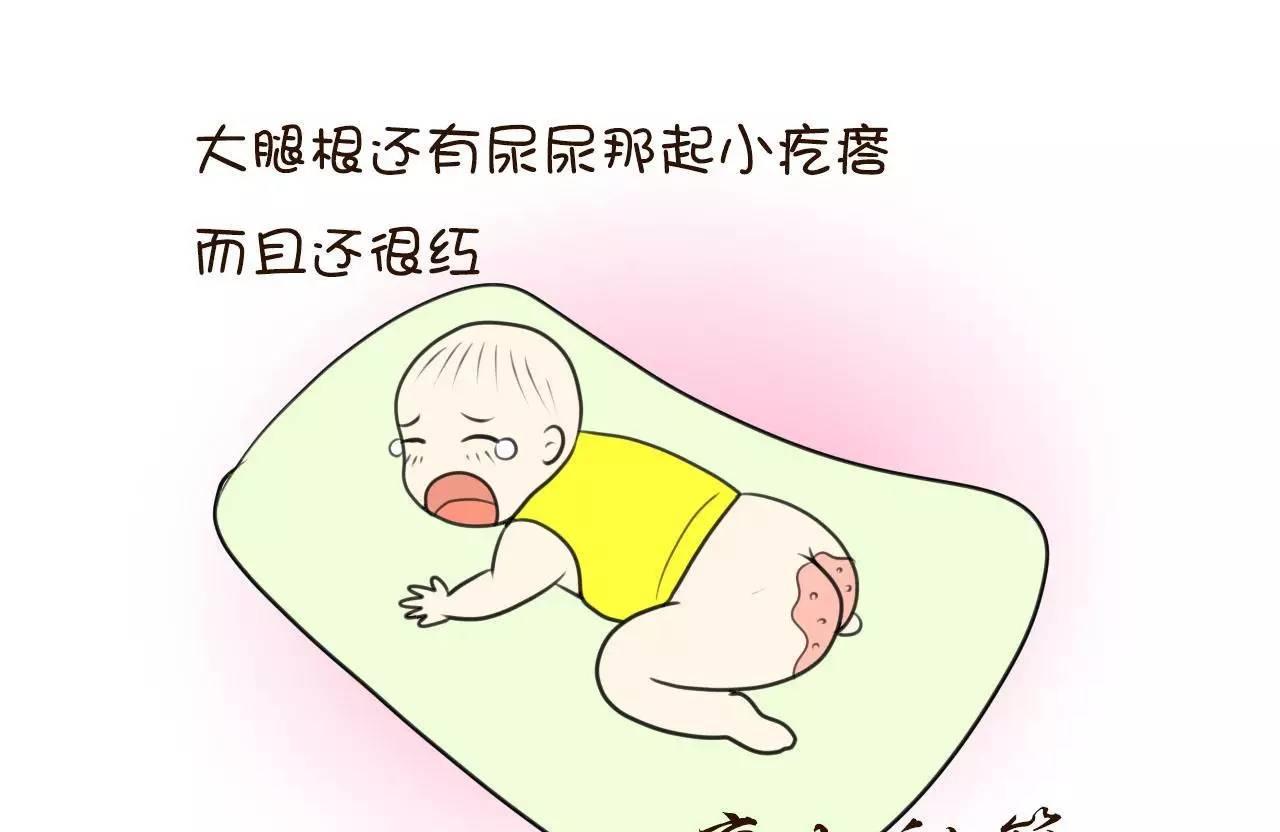 宝宝小屁屁上出现这些东西，可能是它们在作怪