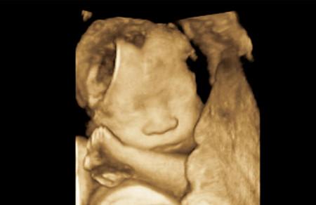 宝宝的第一张照片——三维彩超，让你一分钟就看得懂！