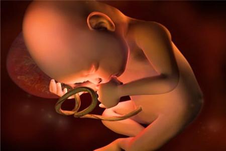 胎儿双侧肾盂无分离是什么意思