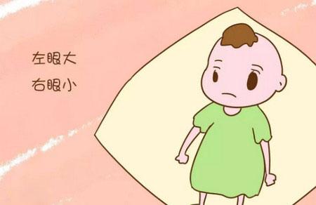 孕期不要长期左侧睡眠，不然像她宝宝一样出生后要受苦了