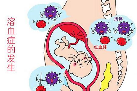 关于宝宝ABO溶血症，O型血的妈妈一定要看看！