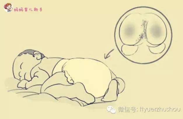 宝宝小屁屁起红疹，妈妈只需这样做即可缓解