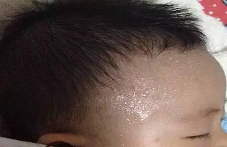 宝宝一睡着就满头大汗，这是缺啥？