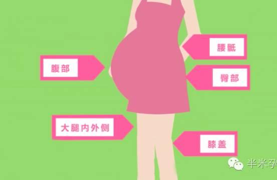 孕妈看过来：教你四招击退妊娠纹！