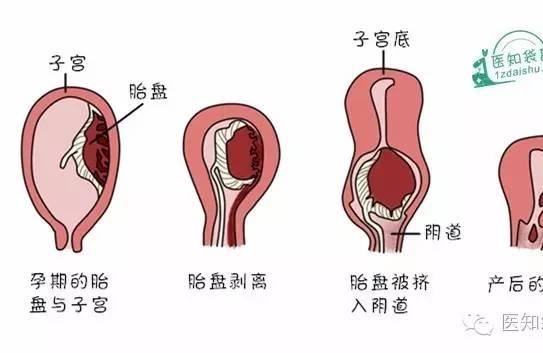 产后恶露是怎么回事？谁说它是脏东西？