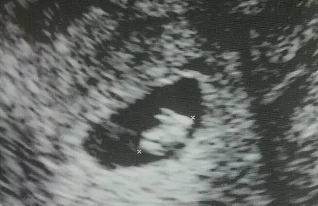 孕妇超声检查，结果她怀了一只“兔子”